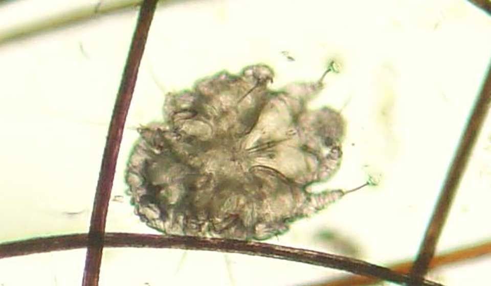 Scabies Mite